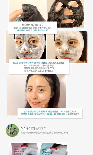 PUREDERM–Deep Purifying Black O2 Bubble Mask (Volcanic)